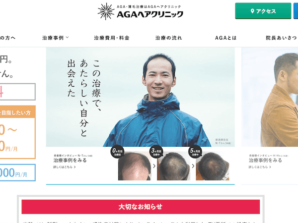 AGAヘアクリニック　